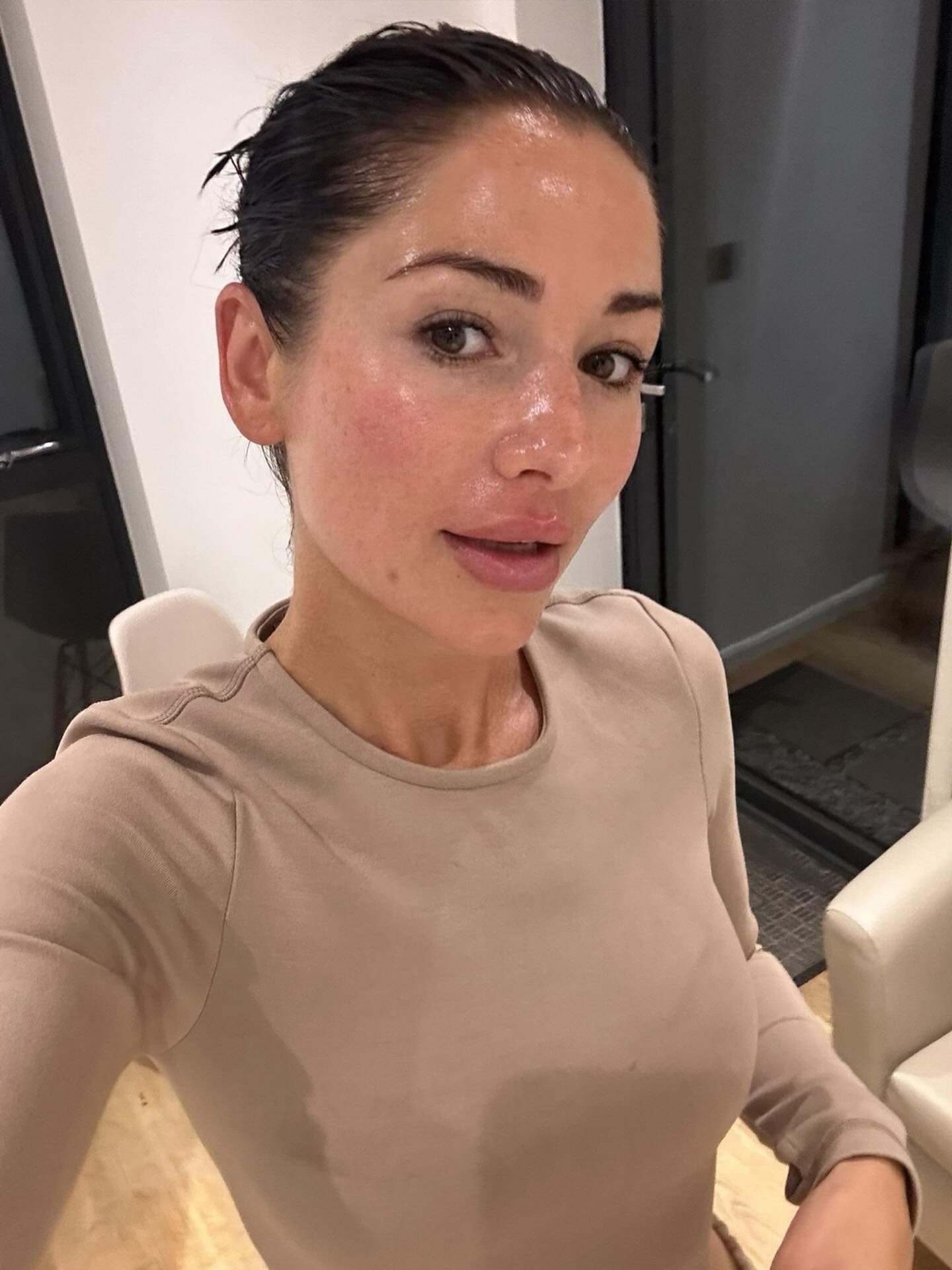 No-filter skin result from dermaplaning and Medik8 expert facial